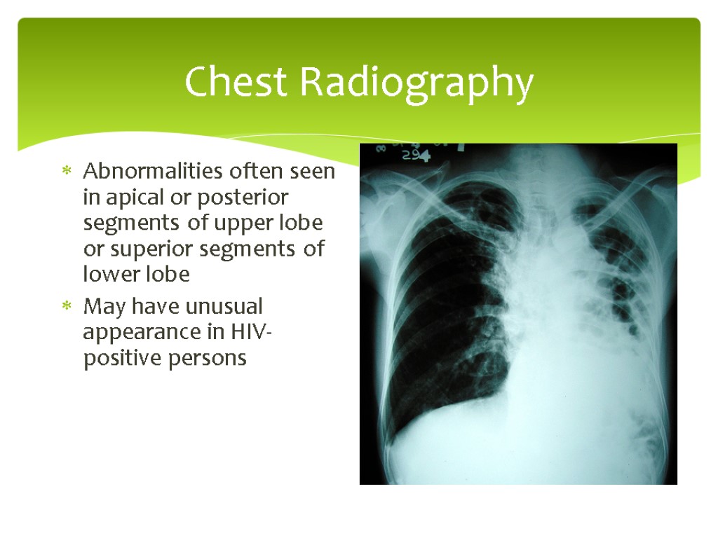 Chest Radiography Abnormalities often seen in apical or posterior segments of upper lobe or